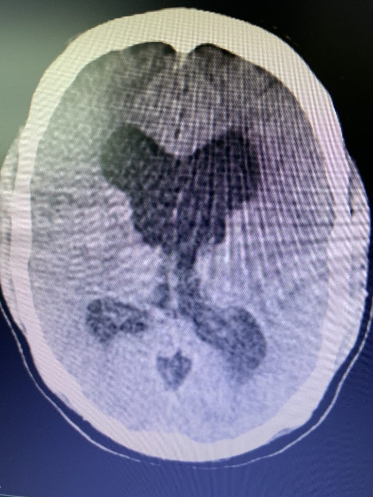 Pre-operative CT images