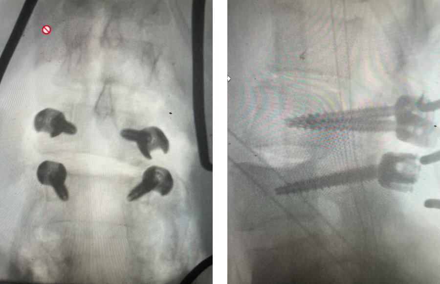 Figure 5 Sometimes WJS