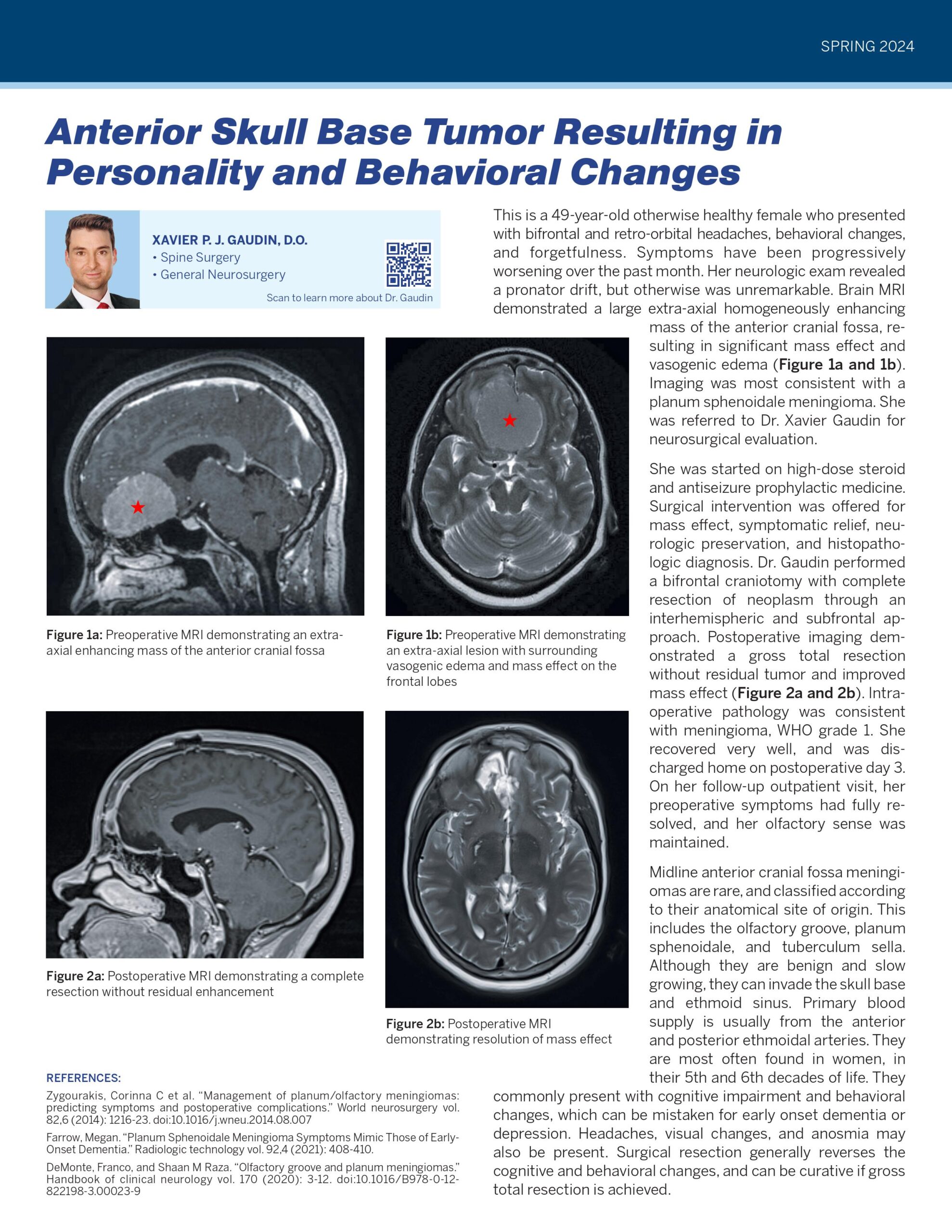 Adult Brain Surgery Update_3-20-24_GC_PROOF-images-2