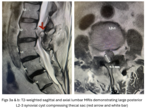 Fig 3a and b Fig 3a and b